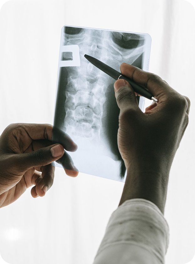 Chiropractor reviewing a spinal X-ray